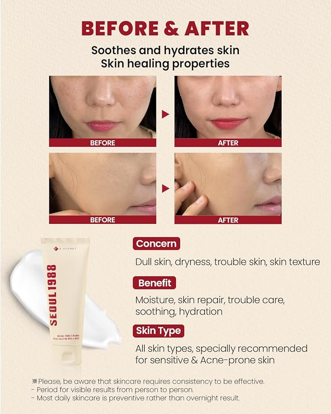 SEOUL 1988 Eye Cream